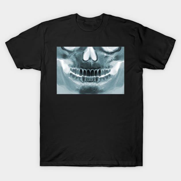 Killer Masks - Skull X-Ray T-Shirt by intofx